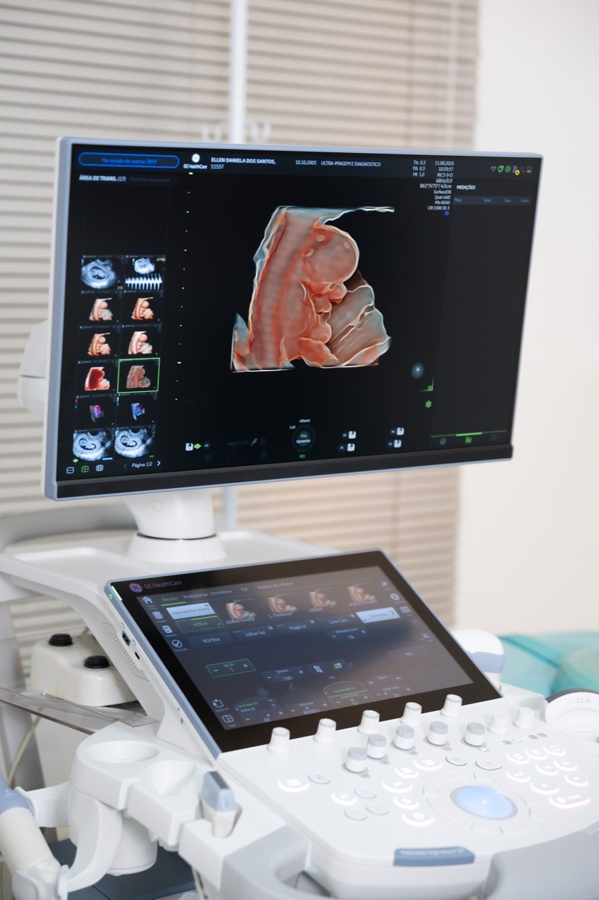 Aparelho de ultrassom com imagem em 3D